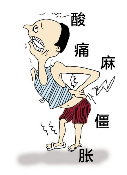 腰椎间盘脱出有什么症状?